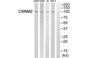 Western blot analysis of extracts from Hela cells, K562 cells, Jurkat cells and A549 cells, using CNNM2 antibody. (Cyclin M2 Antikörper  (Internal Region))