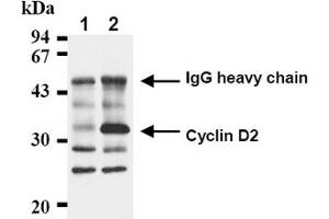 Western Blotting (WB) image for anti-Cyclin D2 (CCND2) antibody (ABIN487478) (Cyclin D2 Antikörper)