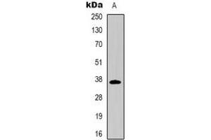 Western blot analysis of CD7 expression in Jurkat (A) whole cell lysates. (CD7 Antikörper)