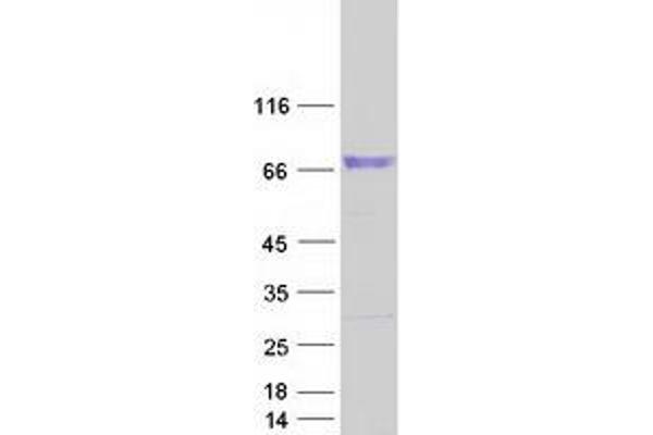 CDH23 Protein (Transcript Variant 2) (Myc-DYKDDDDK Tag)