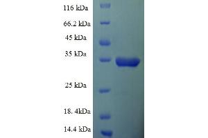 SDS-PAGE (SDS) image for Insulin-Like Growth Factor 1 Receptor (IGF1R) (AA 763-931), (partial) protein (GST tag) (ABIN5709725) (IGF1R Protein (AA 763-931, partial) (GST tag))