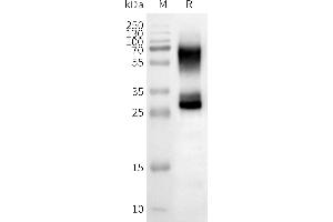 WB analysis of Human OR2B3-Nanodisc with anti-Flag monoclonal antibody at 1/5000 dilution, followed by Goat Anti-Rabbit IgG HRP at 1/5000 dilution (OR2B3 Protein)