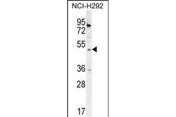 SH2D4A Antikörper  (N-Term)