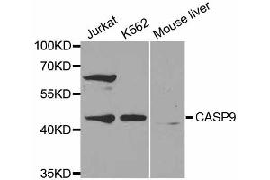 Western blot analysis of extracts of various cell lines, using CASP9 antibody (ABIN5971434) at 1:300 dilution. (Caspase 9 Antikörper)