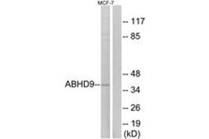 Western Blotting (WB) image for anti-Epoxide Hydrolase 3 (EPHX3) (AA 101-150) antibody (ABIN2890086) (ABHD9 Antikörper  (AA 101-150))