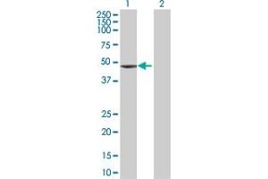 Lane 1: TNNT2 transfected lysate ( 35. (TNNT2 293T Cell Transient Overexpression Lysate(Denatured))