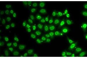 Immunofluorescence analysis of U2OS cells using EWSR1 Polyclonal Antibody (EWSR1 Antikörper)