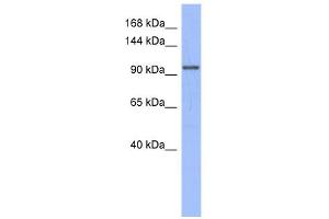 WB Suggested Anti-MSH4 Antibody Titration:  0. (MSH4 Antikörper  (N-Term))