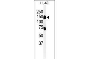 Western blot analysis of T131L Antibody (C-term) (ABIN651155 and ABIN2840102) in HL-60 cell line lysates (35 μg/lane). (TMEM131L Antikörper  (C-Term))
