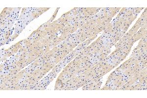 Detection of TGFb1 in Human Cardiac Muscle Tissue using Polyclonal Antibody to Transforming Growth Factor Beta 1 (TGFb1) (TGFB1 Antikörper  (AA 279-390))