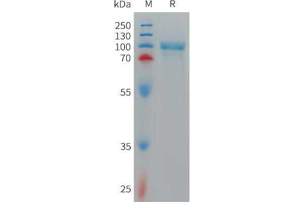 CD93 Protein (CD93) (AA 24-581) (His tag)