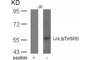 Image no. 1 for anti-Lymphocyte-Specific Protein tyrosine Kinase (LCK) (pTyr505) antibody (ABIN401553) (LCK Antikörper  (pTyr505))