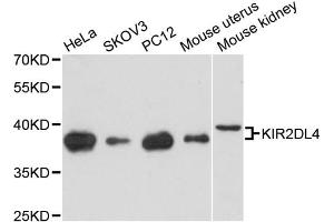 Western blot analysis of extracts of various cell lines, using KIR2DL4 antibody (ABIN6292167) at 1:3000 dilution. (KIR2DL4/CD158d Antikörper)