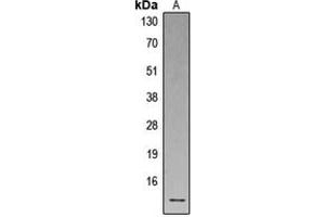 Western blot analysis of Defensin alpha 1 expression in human spleen (A) whole cell lysates. (alpha Defensin 1 Antikörper  (Center))