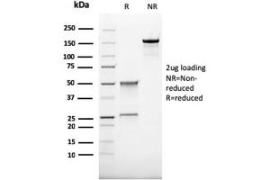 SDS-PAGE (SDS) image for anti-CD68 Molecule (CD68) antibody (ABIN6941238)