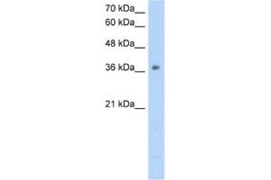 Western Blotting (WB) image for anti-Ornithine Carbamoyltransferase (OTC) antibody (ABIN2462472) (OTC Antikörper)