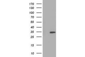 Western Blotting (WB) image for anti-Sulfotransferase Family, Cytosolic, 2A, Dehydroepiandrosterone (DHEA)-Preferring, Member 1 (SULT2A1) antibody (ABIN1501239) (SULT2A1 Antikörper)