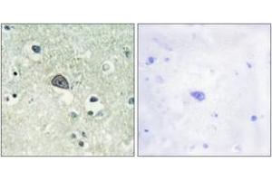 Immunohistochemistry analysis of paraffin-embedded human brain, using NMDAR1 (Phospho-Ser890) Antibody. (GRIN1/NMDAR1 Antikörper  (pSer890))