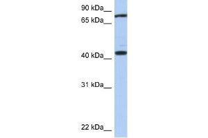 TEX9 antibody used at 1 ug/ml to detect target protein. (TEX9 Antikörper  (Middle Region))