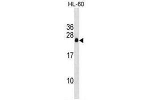 APRG1 Antibody (Center) western blot analysis in HL-60 cell line lysates (35µg/lane). (C3ORF35 Antikörper  (Middle Region))