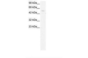 Image no. 3 for anti-General Transcription Factor IIH, Polypeptide 1, 62kDa (GTF2H1) (N-Term) antibody (ABIN202744) (GTF2H1 Antikörper  (N-Term))