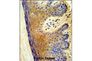 Formalin-fixed and paraffin-embedded human skin tissue reacted with ALOX15B Antibody ,which was peroxidase-conjugated to the secondary antibody, followed by DAB staining. (ALOX15B Antikörper  (C-Term))