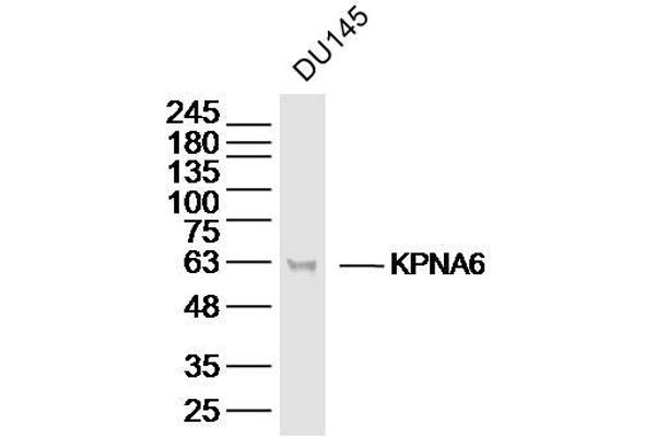 KPNA6 Antikörper  (AA 101-200)