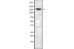 Western blot analysis of EEA1 using Jurkat whole cell lysates (EEA1 Antikörper  (Internal Region))