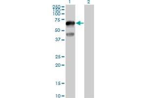 Western Blot analysis of TFCP2L1 expression in transfected 293T cell line by TFCP2L1 MaxPab polyclonal antibody. (TFCP2L1 Antikörper  (AA 1-479))