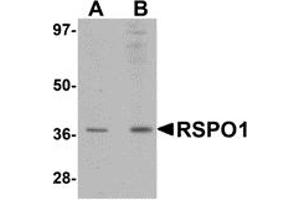 Western Blotting (WB) image for anti-R-Spondin 1 (RSPO1) (N-Term) antibody (ABIN1031546) (RSPO1 Antikörper  (N-Term))