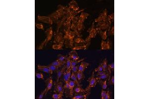 Immunofluorescence analysis of U-2 OS cells using HSD17B8 Polyclonal Antibody  at dilution of 1:100 (40x lens). (HSD17B8 Antikörper  (AA 1-261))