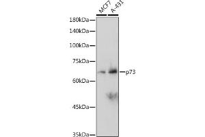 Western blot analysis of extracts of various cell lines, using p73 antibody (ABIN1678945, ABIN1678944, ABIN7101487 and ABIN7101488) at 1:1000 dilution. (Tumor Protein p73 Antikörper)