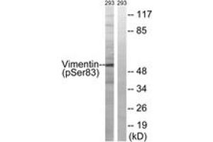 Western blot analysis of extracts from 293 cells treated with paclitaxel 1uM 24h, using Vimentin (Phospho-Ser83) Antibody. (Vimentin Antikörper  (pSer83))