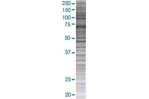 RFX5 transfected lysate. (RFX5 293T Cell Transient Overexpression Lysate(Denatured))