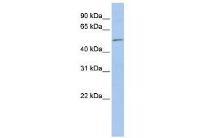WB Suggested Anti-EIF5 Antibody Titration: 0. (EIF5 Antikörper  (N-Term))