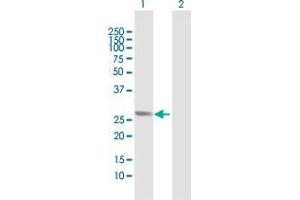 Lane 1: ORC6L transfected lysate ( 28. (ORC6L 293T Cell Transient Overexpression Lysate(Denatured))