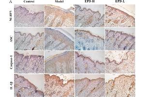 Immunohistochemistry (Paraffin-embedded Sections) (IHC (p)) image for anti-Steroid Sulfatase (STS) antibody (ABIN2170333)