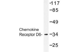 Image no. 1 for anti-Chemokine Binding Protein 2 (CCBP2) antibody (ABIN317628) (CCBP2 Antikörper)