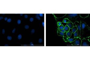 Immunofluorescence (IF) image for anti-Tight Junction Protein 1 (TJP1) antibody (ABIN6655949)