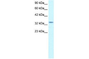 WB Suggested Anti-CLDN16 Antibody Titration:  0. (Claudin 16 Antikörper  (C-Term))