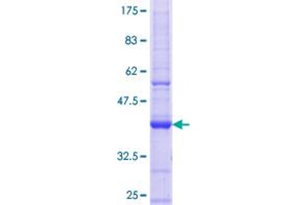 Dermatopontin Protein (DPT) (AA 101-201) (GST tag)