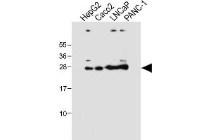 All lanes : Anti-GSTA1 Antibody at 1:4000 dilution Lane 1: HepG2 whole cell lysate Lane 2: Caco2 whole cell lysate Lane 3: LNCaP whole cell lysate Lane 4: NC-1 whole cell lysate Lysates/proteins at 20 μg per lane. (GSTA1 Antikörper)