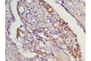 Immunohistochemistry (Paraffin-embedded Sections) (IHC (p)) image for anti-Chemokine (C-C Motif) Receptor 7 (CCR7) (AA 25-59) antibody (ABIN674724)