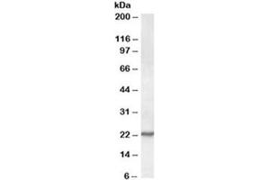 Western blot testing of NIH3T3 lysate with SAR1 antibody at 0. (SAR1A Antikörper)