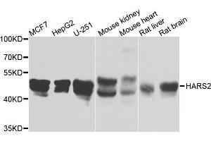 Western blot analysis of extracts of various cells, using HARS2 antibody. (HARS2 Antikörper)