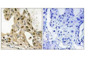 Immunohistochemistry (IHC) image for anti-Tumor Protein P53 (TP53) (pThr387) antibody (ABIN1847562) (p53 Antikörper  (pThr387))