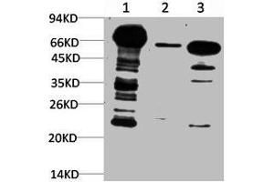 Western blot analysis of 1) Hela Cell Lysate, 2) 3T3 Cell Lysate, 3) Rat Brain Tissue Lysate using Ubiquitin Mouse mAb diluted at 1:1000. (Ubiquitin Antikörper)