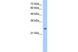 WB Suggested Anti-PRDX6 Antibody Titration:  1. (Peroxiredoxin 6 Antikörper  (Middle Region))