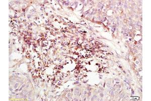 Immunohistochemistry (Paraffin-embedded Sections) (IHC (p)) image for anti-Chemokine (C-X-C Motif) Receptor 4 (CXCR4) (AA 201-294) antibody (ABIN730888)