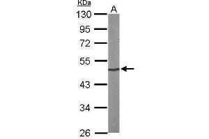 WB Image Sample (50 ug of whole cell lysate) A: Mouse brain 10% SDS PAGE antibody diluted at 1:1000 (PRKX Antikörper)